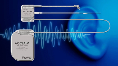 Акции разработчика слуховых имплантов взлетели после анонса испытаний нового аппарата