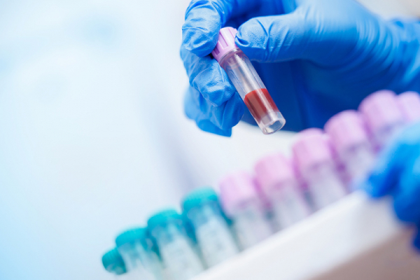 Онколог рассказала, какие анализы крови могут помочь обнаружить рак