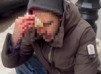 Две глыбы льда, сорвавшиеся с крыш, отправили в больницу парня и девушку - видео 15/02/2026 &ndash; Новости